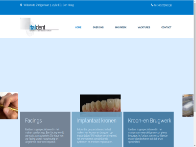 0 06 0622766136 2021 22766136 2582 3 3543299 70 behor bepaald brugg brugwerk complex contact den ed ervar estetisch facing gemaakt gespecialiseerd hag hom i implantat in/onlays instagram italdent kleur kron kroon- laboratorium les locatie mak material meerdel merk nauwkeur onz porselein specialiteit system taldent tandtechnisch tel uitgebreid vacatures verschill werk wij willem zwijgerlan