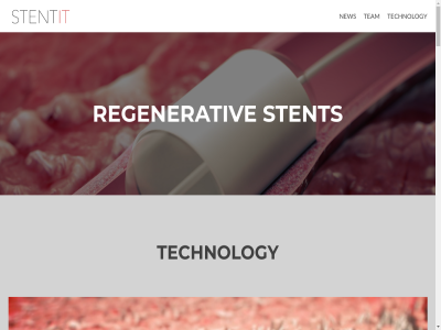 +31 0 1 10 16 3 4 40 5 5656ae 6 64 8 85 8516431 at by campus content eindhov high info@stentit.com intelligent lit new our partner powered regenerativ skip stent stentit stentit.com team tech technology to wordpres zerif