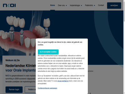 00 085 09024387802 1 12 13 130 14 15 17 19020027602 2 20 2009 2025 2026 2161 29910863702 3 30 30270574 4 49021896802 5 6 8 9 99 aanbied aanmet aanpass aanvull accepter advertenties akkoord algemen analytisch app behandel bekijk bent beroep best betekent big bijkom blom brug buurt contact control cookie cookies cookievoorkeur daarnaast daarom dagelijk december del di dienst disclaimer do doeleind dr druk e e-mail en en/of erik erkend ervar ervor esdoornlan extern gebruik geeft geholp gemaakt geplaatst gerustgesteld gespecialiseerd gevall gevoeld gewon gezell goed hel helemal help henri hiervan hildina hom huso implantat implanter implantolog implantologie implantologisch info@nkoi.nl informatie ingewikkeld ingrep inmiddel j.j jan januari jonker kaakchirurg kenn kiez klikgebit kliniek krijgt kron kunt kvk kwaliteit leest ler les lis login ma mail mak media mogelijk mr nadat napijn nederland nik nkoi noodzak nummer nvoi nvoi-erk o.a onderdel ondergan onderscheid onlin onwijs onz opleid opricht oral pagina partner passie patient patientinfo pieter plaats plaatsvindt praktijk privacy privacybeleid privacyverklar prothes relevant relevanter s salihovic samenwerk sfer sind snel social specialist statement succesvol tandart tandarts tandarts-implantolog tandartsassistent tandartspraktijk tandprotheticus tariev team terecht tientall top topkwaliteit trot tuss uijlenbroek uiteind uitgegroeid uitgevoerd verdov vertrouw verwijs verwijz verzamel verzorg verzorgt via volg volled voordel voorwaard we websit websites wek wel welkom werkt wet wij will wo za zien zorg