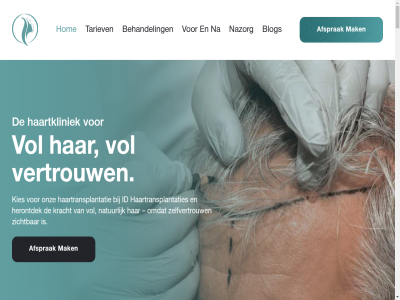 06 17 2025 2044 2288 250 2500 30 31 3500 5448 86416642 aandacht aanleg aanpak aanvull adres advies adviser af afgestemd afsprak allen allereerst alopecia also and ander androgenetica are artikel basis beantwoord begeleid begint behandel behandelmethod behandelplan bekijk bel belangrijk belangrijkst benieuwd bent bepaald bereik bericht beslot besprek best bested betal bevorder bied bijdrag bit blijv bloed bloedplaatjes blog blogsectie btw but client confidenc contact contactformulier content control controle-afsprak cosmetic daarna daarnaast dankzij dhi dhi-method dicht dieetaanpass dikker direct do doorbloed drie drom duidelijk dunner duurzam e e-mail echt eenvoud eerlijk eerst eig ek email en erfelijk ernar ervar ervaringsverhal eventuel expert extra facebok fases fijn follow follow-up for foto galerij gan gat gebruik gebruikgemaakt gecentrifugeerd geconcentreerd geinjecteerd generation genez gepersonaliseerd gerust geschikt gespecialiseerd gewenst goed graft grag grootst growth haardos haargroei haargroeistimuler haarherstel haarkliniek haartkliniek haartranslantaties haartransplantatie haartransplantaties haartyp haaruitval haarzakjes hair hangt har help helpt hernieuwd herontdek herstel hersteltijd hierbij hightech hog hom hoofdhuid hoofdhuidconditie hoogt hormonal houd houdt iban id identiteit impact implantatie implantation implanter implanterpenn incisie indien info@idhaartransplantaties.nl informatie informatiev ingrep innovatiev inplann inspirer instagram intak intakegesprek january jou jouw juist kan keuz kies kiez kijkj klar kort kracht krijg kun kunt kvk laatst lang langdur les lifestyl lifestyle-advies lik littekenvorm littl los mail mak manier mann maximal medicatie mee meerder meest method middel minder minimal minsten modern mog mogelijk moment monitor mooist n na-galerij nam natur nauwkeuriger nauwlet nazorg nazorgadvies nazorgafsprak nazorgtip nazorgtraject nem nieuw nieuwst nl31abna0116818751 nl863960169b01 not nowaday nummer nutrition ogen ogend 