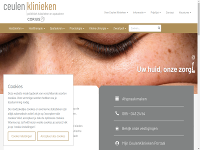 043 085 100 198 2 2026 24 3 54 6 8 8.6 aambei aandachtsgebied aanmeld aanzet accepter actief afsprak algemen all alledag amersfoort anoniem apparatur automatisch begeleider behandel bekijk belemmer bent beschik best bied blijvend breda buitenpoli centrum ceul ceulenkliniek chirurgie cijfer contact cookie cookies correct cosmetiek cosmetisch crer dagelijk definitief denk dermatologie dermatologisch disclaimer doorlooptijd drog eerst eigenar eind en end focus fris gebruik gegeven gekom gelad gemiddeld geniet gesteld geur gevond gewaardeerd gezond gezondheidsomgev googl grip grot helmond hierbij hoogwaard huid huidkanker huidtherapeutisch huidtherapie huidziekt huisregel hyperhidrosis indicatie inegi informatie instell kaartgegeven ker kies kiez klachtenregel klein klik klikt kliniek komst krijg label last les lev locatie maakt maarss mak map medisch minimal miradry mogelijk naast nederland net neveneffect nieuwst nodig noodzak ok oksel okselgebied onaangenam onz oploss opnem optionel overmat pagina patient person pgo policy polikliniek portal prijslijst privacyreglement proctologie resultat schiedam sneltoets sommig soort spatader specialism specialist specialistisch stan statistiek ter terugbel toestemm top tuss uden uitrust utrecht vacatures vanaf verdient vergoed verlen verschill vervolgafsprak verwijzer verzekerd verzoek vestig vinkeven vloeiend voorbereid voorwaard vrag waarder wachttijd wanner we websit wek welk wij wilt zelfstand ziekenhuis zoal zoek zorg zorgverzekerar zweetplek zweetpoli zwet